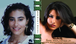 Tahra Hmamich from Morocco before and after picture