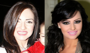 Diana Karazon vs  Wafaa Soltan